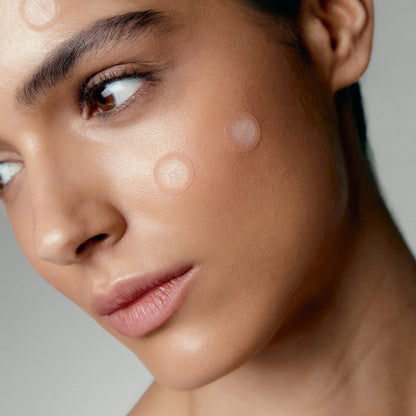 Masqmai Microneedle Pimple Mask